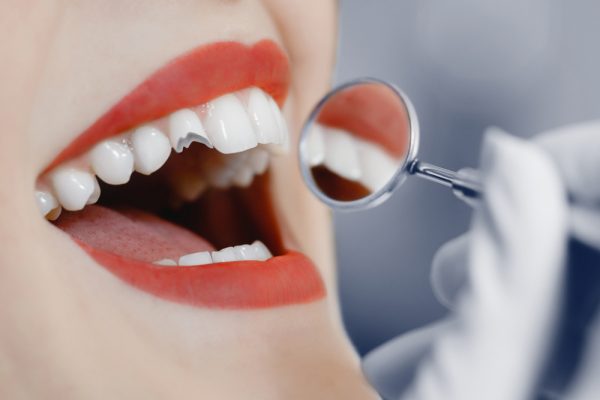 female patient with broken tooth getting examined by a dentist